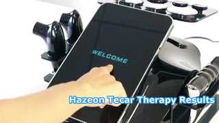 เครื่องบำบัด Hazeon Tecar RL-W20 – อุปกรณ์กายภาพบำบัดและการฟื้นฟูสมรรถภาพขั้นสูง 448kHz