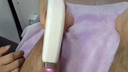 เครื่องกำจัดขนด้วยเลเซอร์ไดโอด 808nm พร้อมพลังงาน 1-50A ความกว้างพัลส์ 1-400ms สำหรับ 6 ประเภทผิว